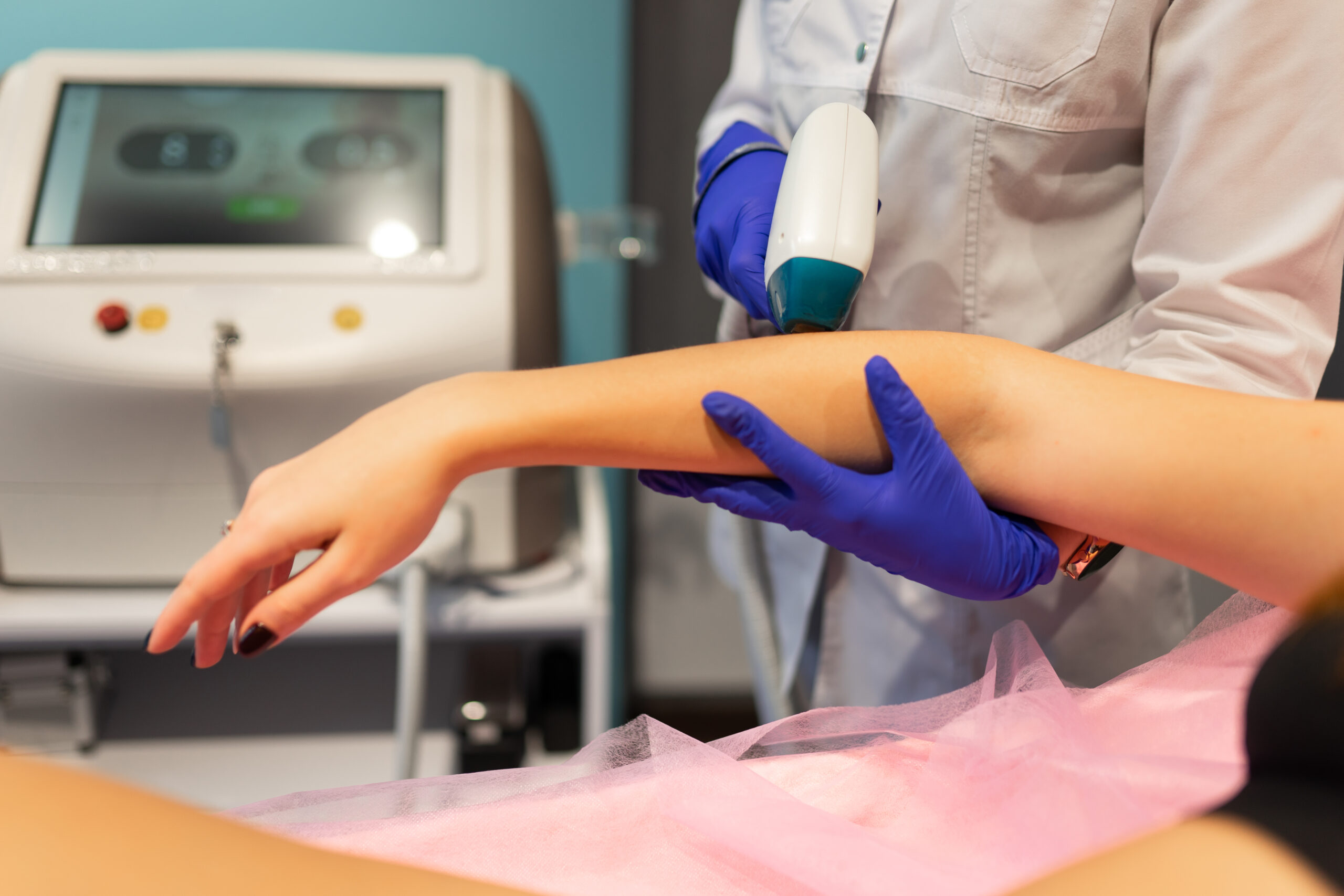 A specialist performing professional laser hair removal treatment on a client at Athena Mortlake in Richmond.